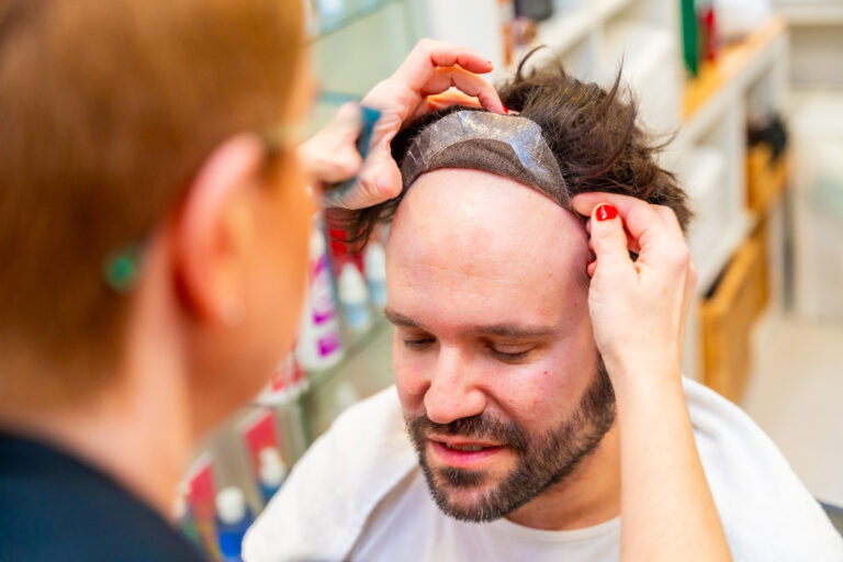 Applicazione della patch capillare uomo